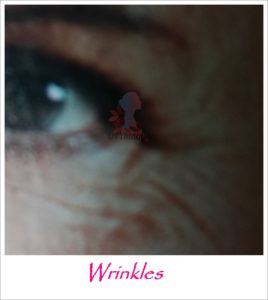 wrinkles o kulubot sa mukha